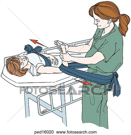 Child undergoing closed-joint reduction of the shoulder; technique shown with patient's trunk wrapped in sheet, tied to opposite side of bed rails; second sheet around doctor's waist, pt. 's forearm placed within 2nd sheet, longitudinal traction applied, View Large Illustration Clipart - Child undergoing closed-joint reduction of the shoulder; technique shown with patient's trunk wrapped in sheet, tied to opposite side of bed rails; second sheet around doctor's waist, pt. 's forearm placed within 2nd sheet, longitudinal traction applied, . Fotosearch