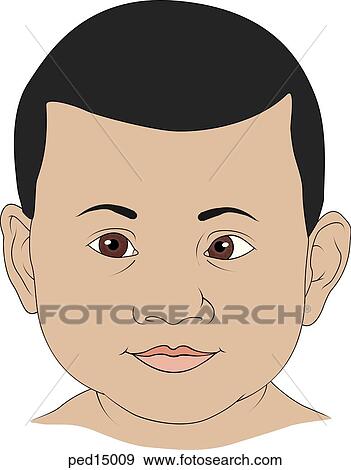 Close up of a child's face; left eye deviates inward toward the nose. View Large Illustration Stock Illustration - Close up of a child's face; left eye deviates inward toward the nose.. Fotosearch