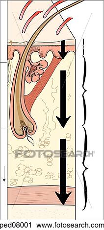 Cross-section of skin layers, muscle, and bone, with corresponding classification of burn depths. View Large Illustration Clip Art - Cross-section of skin layers, muscle, and bone, with corresponding classification of burn depths.. Fotosearch