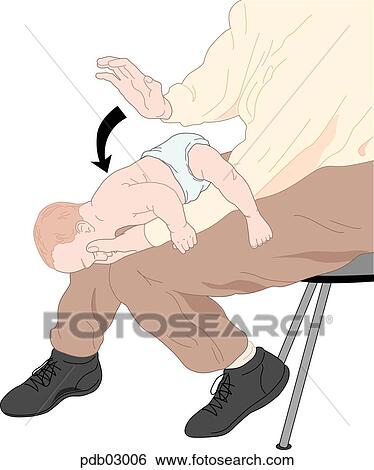 Stock Illustration - Drawing demonstrating back blow administration to infant to clear blocked airway.. Fotosearch