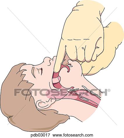 Drawing demonstrating method for finger sweeping. View Large Illustration Stock Illustration - Drawing demonstrating method for finger sweeping.. Fotosearch