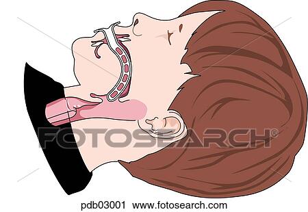 Drawing of child's head and neck showing the oropharyngeal airway in position. View Large Illustration Clip Art - Drawing of child's head and neck showing the oropharyngeal airway in position.. Fotosearch