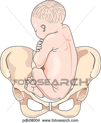 Stock Illustration - Drawing showing fetus over bony pelvis, buttocks toward birth canal.. Fotosearch