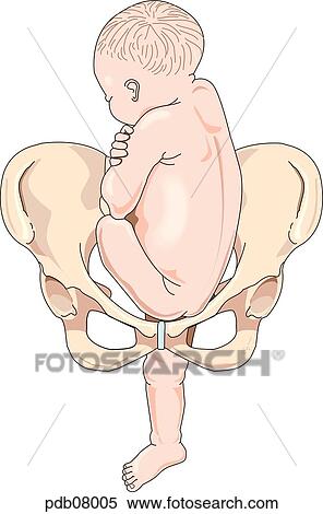 Drawing showing fetus over bony pelvis, buttocks toward birth canal, and one foot in birth canal. View Large Illustration Stock Illustration - Drawing showing fetus over bony pelvis, buttocks toward birth canal, and one foot in birth canal.. Fotosearch