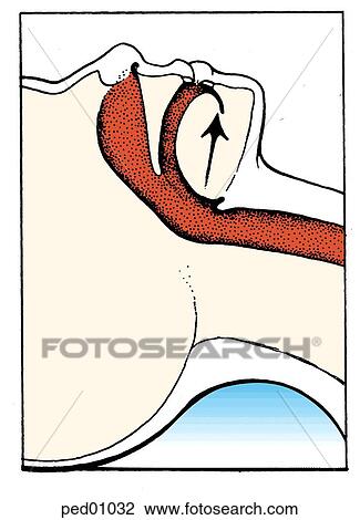 Fully open airway through use of jaw thrust or jaw lift. View Large Illustration Drawing - Fully open airway through use of jaw thrust or jaw lift.. Fotosearch
