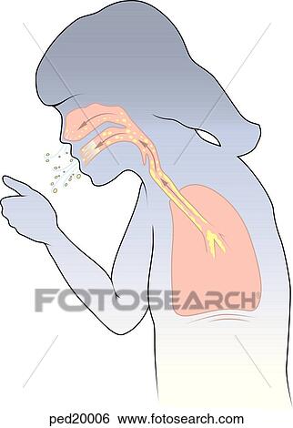 Girl in process of coughing forcing mucous buildup up through trachea and out the mouth and nose. View Large Illustration Stock Illustration - Girl in process of coughing forcing mucous buildup up through trachea and out the mouth and nose.. Fotosearch