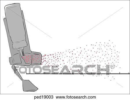 Drawing - Illustration of a metered dose inhaler with aerosol cloud; specifically noted is distribution of propellant to medication.. Fotosearch