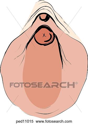 Illustration of an imperforate hymen. Stock Illustration | ped11015