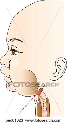 Illustration showing epiglottis of an infant and its relationship to the trachea and vocal cords; in an infant, the epiglottis is at an angle relative to the axis of the trachea (dashed lines); infant's vocal cords have a lower attachment anteriorly tha View Large Illustration Drawing - Illustration showing epiglottis of an infant and its relationship to the trachea and vocal cords; in an infant, the epiglottis is at an angle relative to the axis of the trachea (dashed lines); infant's vocal cords have a lower attachment anteriorly tha. Fotosearch