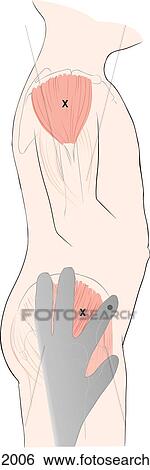 Illustration showing various sites for intramuscular injection in children. View Large Illustration Stock Illustration - Illustration showing various sites for intramuscular injection in children.. Fotosearch