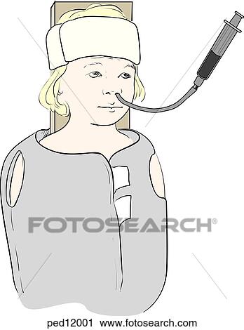 Clip Art - Illustration shows a restrained child being administered activated liquid charcoal via a nasogastric tube.. Fotosearch
