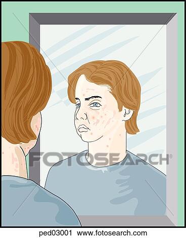 Illustration shows a young man with acne looking in the mirror. View Large Illustration Clip Art - Illustration shows a young man with acne looking in the mirror.. Fotosearch