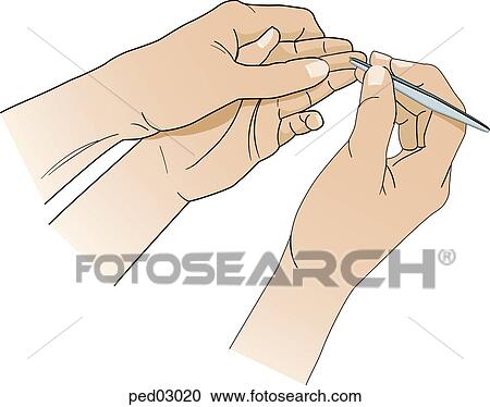 Illustration shows the hands of an adult removing splinter from finger of child; adult left hand holds child's hand and finger firmly; adult right hand uses tweezers to pull splinter from middle finger of child's left hand. View Large Illustration Clipart - Illustration shows the hands of an adult removing splinter from finger of child; adult left hand holds child's hand and finger firmly; adult right hand uses tweezers to pull splinter from middle finger of child's left hand.. Fotosearch