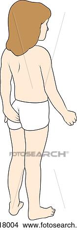 Stock Illustration - Image shows young child scratch the anal region, an indication of pinworm (Enterobius vermicularis) infestation.. Fotosearch