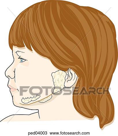 Lateral view of child showing location of the salivary glands; sublingual, submandibular, and parotid. View Large Illustration Drawing - Lateral view of child showing location of the salivary glands; sublingual, submandibular, and parotid.. Fotosearch