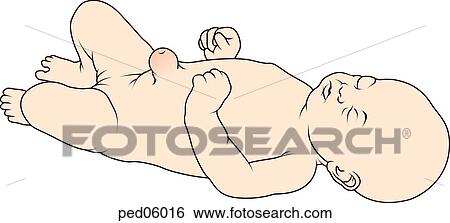 Neonate with visible umbilical hernia. View Large Illustration Stock Illustration - Neonate with visible umbilical hernia.. Fotosearch