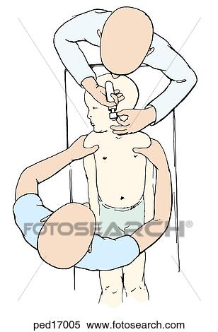 Otolaryngologist examing a toddler's ear with a pneumatic otoscope; child is placed in a supine position and is held in place by the parent. View Large Illustration Stock Illustration - Otolaryngologist examing a toddler's ear with a pneumatic otoscope; child is placed in a supine position and is held in place by the parent.. Fotosearch