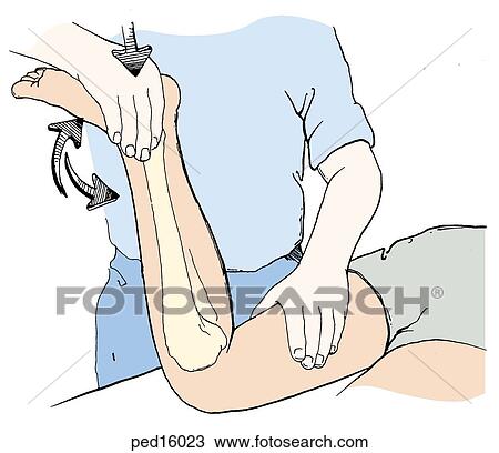Patient is seen from waist down, prone, with knee flexed to 90?, heel raised; doctor stands nearby with right hand on pt. 's heel, left hand on pt. 's thigh; pressure is applied to heel while tibia is rotated; bones of lower leg visible. View Large Illustration Drawing - Patient is seen from waist down, prone, with knee flexed to 90?, heel raised; doctor stands nearby with right hand on pt. 's heel, left hand on pt. 's thigh; pressure is applied to heel while tibia is rotated; bones of lower leg visible.. Fotosearch