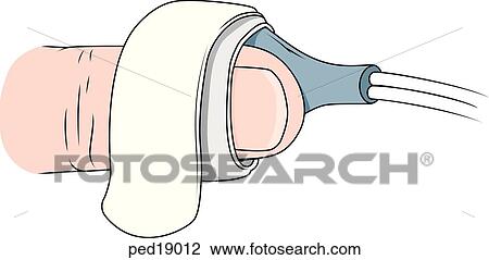 Pulse oximetry probe attached to finger of child. View Large Illustration Drawing - Pulse oximetry probe attached to finger of child.. Fotosearch