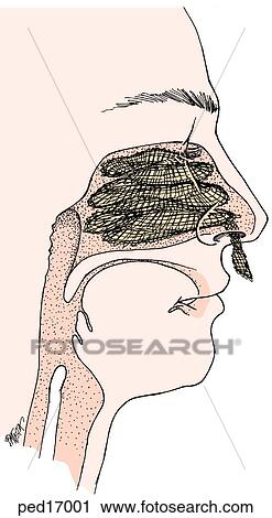 Sagittal View Of Nasal Cavity Firmly Filled With Ribbon Gauze