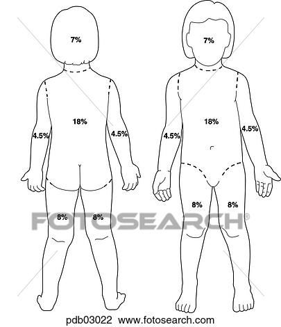 Schematic drawing of child showing body surface areas as percent of whole; used in calculating burn damage. View Large Illustration Drawing - Schematic drawing of child showing body surface areas as percent of whole; used in calculating burn damage.. Fotosearch