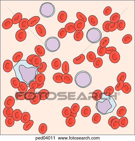 Clip Art - Schematic representation of a blood smear as seen through a microscope; unusual number of monocytes and macrophages would suggest mononucleosis; smaller disk-shaped cells are erythrocytes.. Fotosearch