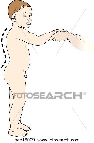 Toddler, from side, showing natural lordorsis for age. View Large Illustration Stock Illustration - Toddler, from side, showing natural lordorsis for age.. Fotosearch