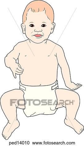Clipart - Toddler with positional deformity of hand and arm (birth-Erb's palsy).. Fotosearch