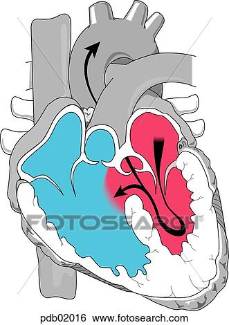 Transection view of heart showing chambers; lower arrow demonstrates blood flowing between cardiac ventricles through opening in the ventricular septum. View Large Illustration Stock Illustration - Transection view of heart showing chambers; lower arrow demonstrates blood flowing between cardiac ventricles through opening in the ventricular septum.. Fotosearch