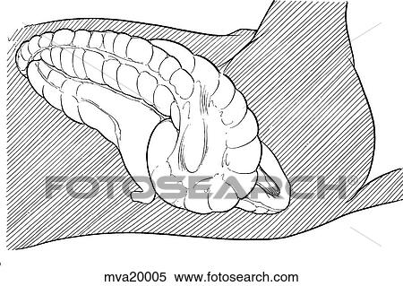 ねじれ の 大きい 腸 Equine イラスト Mva005 Fotosearch