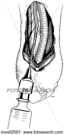 Carotid artery, bird View Large Illustration Clip Art - Carotid artery, bird. Fotosearch
