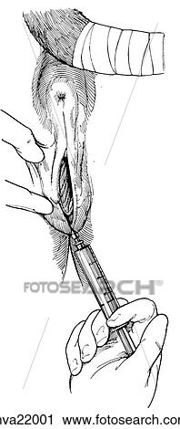 Clip Art - Caslick's operation, equine. Fotosearch