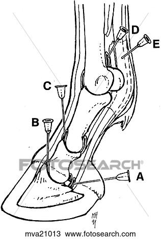 Coffin, pastern, and fetlock joint, equine View Large Illustration Drawing - Coffin, pastern, and fetlock joint, equine. Fotosearch