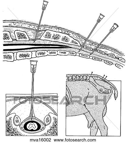 Drawing - Epidural analges, bovine. Fotosearch