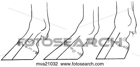 Foot and pastern axis, equine View Large Illustration Drawing - Foot and pastern axis, equine. Fotosearch