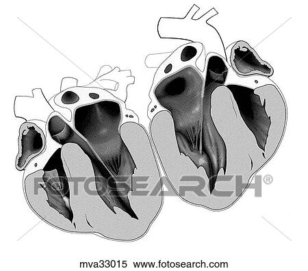 Stock Illustration - Heart, canine. Fotosearch