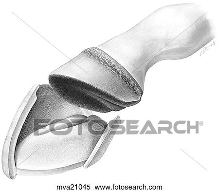 Stock Illustration - Hoof, equine. Fotosearch