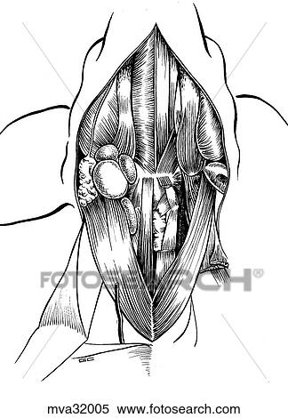 Hyoid muscles, canine View Large Illustration Stock Illustration - Hyoid muscles, canine. Fotosearch
