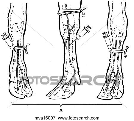 Stock Illustration - Intravenous region analgesia, bovine. Fotosearch