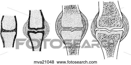 Joint development, equine View Large Illustration Stock Illustration - Joint development, equine. Fotosearch
