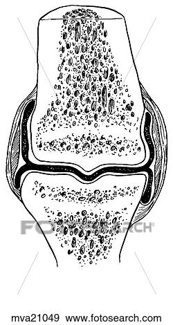 Joint, synovial, equine View Large Illustration Stock Illustration - Joint, synovial, equine. Fotosearch