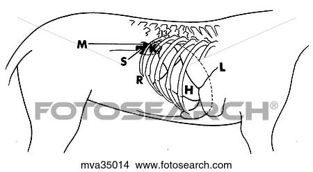 Stock Illustration - Keyhole technique percutaneous renal biopsy. Fotosearch