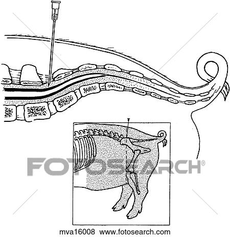 Stock Illustration - Lumbosacral epidural anesthesia, pig. Fotosearch