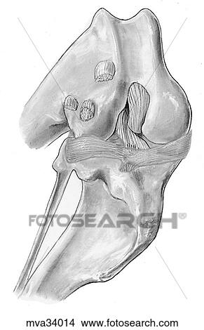 Menisci and cruciate ligaments, canine View Large Illustration Stock Illustration - Menisci and cruciate ligaments, canine. Fotosearch