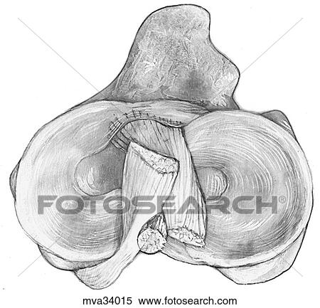 Stock Illustration - Menisci of the stifle joint, canine. Fotosearch