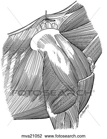 Muscles and ligaments of shoulder, equine View Large Illustration Drawing - Muscles and ligaments of shoulder, equine. Fotosearch