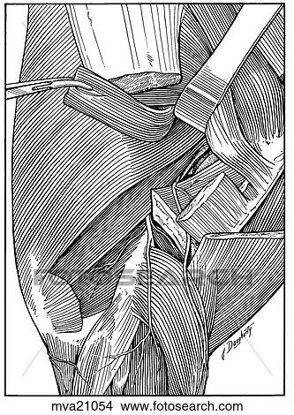 Muscles and nerves of shoulder, equine View Large Illustration Stock Illustration - Muscles and nerves of shoulder, equine. Fotosearch