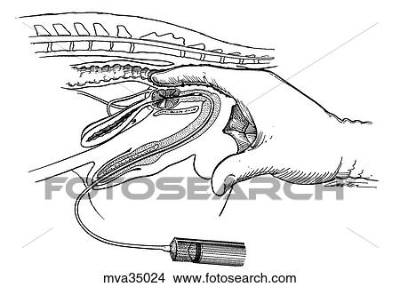 Prostatic massage, canine View Large Illustration Stock Illustration - Prostatic massage, canine. Fotosearch