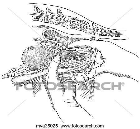 Prostatic massage, canine View Large Illustration Stock Illustration - Prostatic massage, canine. Fotosearch