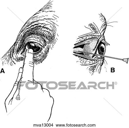 Stock Illustration - Retrobulbar needle placement, bovine. Fotosearch